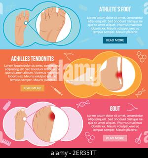 Jeu de bannières horizontales plates avec problèmes de pieds isolés illustration vectorielle d'arrière-plan colorée Illustration de Vecteur