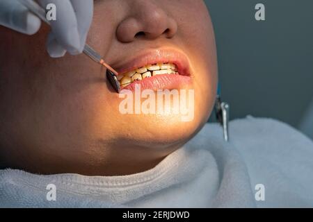 Dentiste tenant un miroir de magification tout en vérifiant les dents des appareils orthodontiques pour la femme Banque D'Images