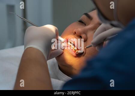 Femme avec des supports de dents ayant un contrôle dentaire à la clinique Banque D'Images