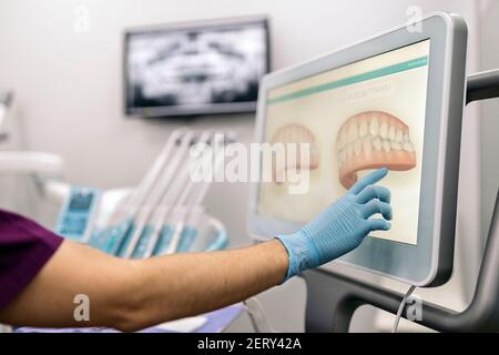 Photo d'un travailleur non reconnu de la clinique dentaire montrant une radiographie à un patient. Banque D'Images