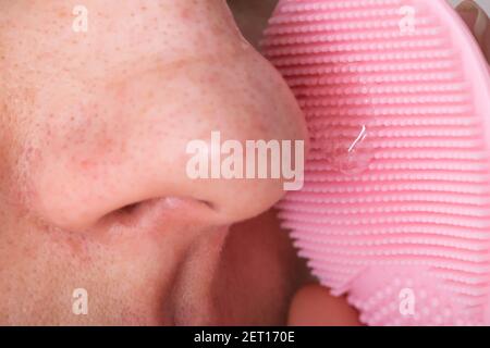 La fille nettoie les pores obstrués sur la peau de le nez avec une brosse en silicone pour nettoyer le visage Banque D'Images