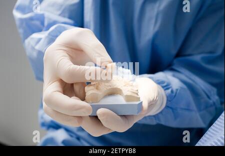 dentiste médecin avec dent et prothèse dans les mains, avec gants chirurgicaux Banque D'Images