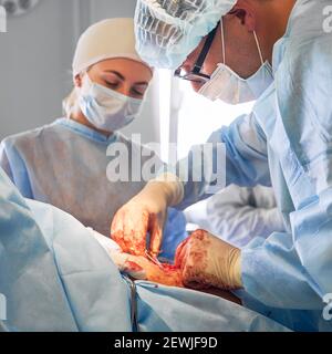 Médecins effectuant la chirurgie de l'abdominoplastie en clinique. Chirurgien plastique mâle et assistante femelle effectuant une chirurgie plastique abdominale dans la salle d'opération. Concept de médecine, tummy tuck, chirurgie esthétique Banque D'Images