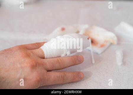 KATOWICE, POLOGNE - 03 mars 2021 : une main avec un doigt cassé et en piqûre fendue repose sur une table chirurgicale blanche Banque D'Images