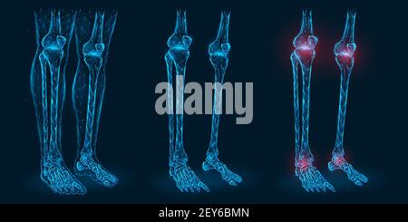 Douleur, blessure ou inflammation dans les genoux et les chevilles illustration du vecteur polygonal. Modèle poly bas des articulations du genou et de la cheville malades. Illustration de Vecteur