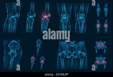 Douleur, blessure ou inflammation dans les genoux et le bassin illustration du vecteur polygonal. Modèle bas en polyéthylène d'une articulation mal au genou, à la hanche et à la hanche. Illustration de Vecteur