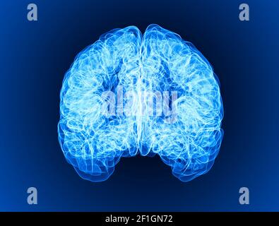 Douleur dans la tête, le cerveau et les synapses, problèmes cognitifs, déficit mental. Anévrisme. Maladies dégénératives affectant la région du cerveau. Parkinson, accident vasculaire cérébral Banque D'Images