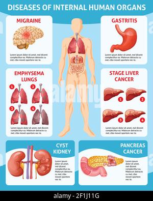 Caricature de soins médicaux concept infographie avec différentes maladies internes illustration du vecteur des organes humains Illustration de Vecteur