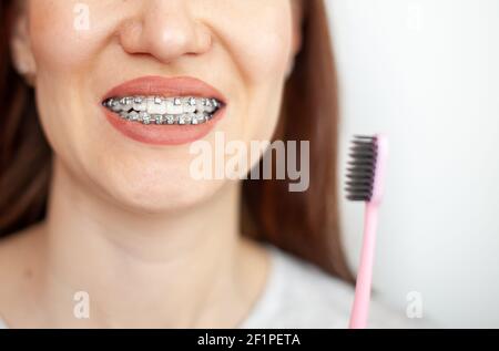 Une jeune fille avec des bretelles sur ses dents blanches se brosse les dents avec une brosse à dents. Lissage et hygiène dentaire. Soins dentaires. Banque D'Images