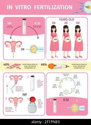 Concept d'infographie sur la fécondation in vitro avec processus et procédures de insémination artificielle et les chances de grossesse dans différents âges vecteur Illustration de Vecteur