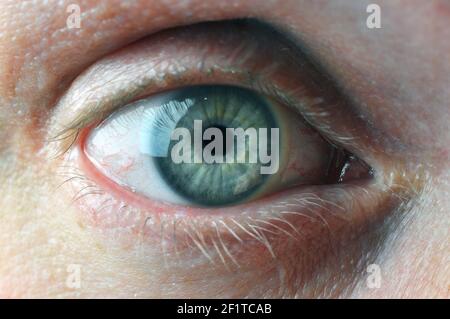 Œil d'homme avec lentilles de contact et capillaires sanguins. Prise de vue macro. Banque D'Images