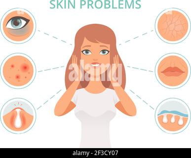 Problèmes de peau. Beauté femme soin de gommage visage infection noirceur gommages visage gras nettoyer symboles vectoriels Illustration de Vecteur