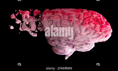 La mémoire est caduque, oubliant les choses, maladie dégénérative. Problèmes de cerveau. Maladie de Parkinson et maladie d'alzheimer. Santé mentale. AVC, synapses et neurones Banque D'Images