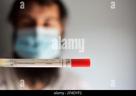 Infirmière tenant un tube. Test de dépistage du rotavirus. Homme portant un masque facial saisissant un échantillon de fèces à examiner en laboratoire Banque D'Images