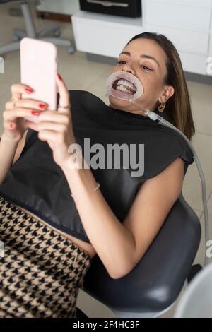 Patiente avec enrouleur dans la bouche allongé sur une chaise dentaire et prendre un cliché sur votre smartphone avant de vous faire soigner en clinique Banque D'Images