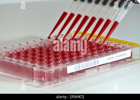 criblage à haut débit d'échantillons covid-19 avec une pipette multicanaux sur une plaque de microtitration à grande échelle Banque D'Images