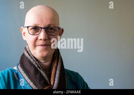 Femme adulte mature avec AEC du syndrome de Hay Wells, un défaut génétique provoquant la croissance anormale, défectueuse de la peau, des ongles et des cheveux. La condition médicale connexe est le syndrome EEX ou l'ectrodactylie. Elle travaille en tant que Freelance, Psycho social Therapist, soutenant d'autres personnes qui font face à des questions si la vie. Banque D'Images