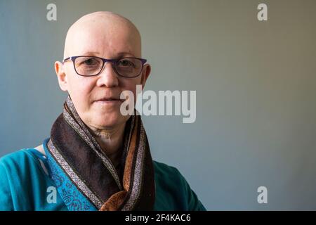 Femme adulte mature avec AEC du syndrome de Hay Wells, un défaut génétique provoquant la croissance anormale, défectueuse de la peau, des ongles et des cheveux. La condition médicale connexe est le syndrome EEX ou l'ectrodactylie. Elle travaille en tant que Freelance, Psycho social Therapist, soutenant d'autres personnes qui font face à des questions si la vie. Banque D'Images