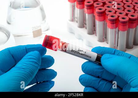 Science, médecine et pharmacie concept avec le médecin effectuant des tests sanguins sur des échantillons médicaux tout en portant des gants de protection en latex bleu en laboratoire et holdi Banque D'Images