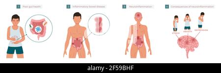 Une mauvaise santé intestinale entraîne une inflammation chronique, qui à son tour entraîne une neuroinflammation, qui peut causer du stress, de l'anxiété et de la dépression. Vecteur illus Illustration de Vecteur