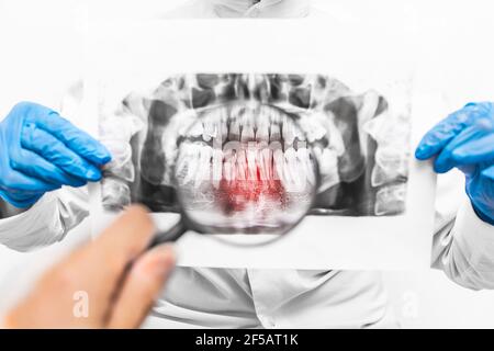 Les mains du dentiste dans des gants médicaux en latex bleu tiennent un cliché de la bouche et l'examine à l'aide d'une loupe, gros plan. Banque D'Images