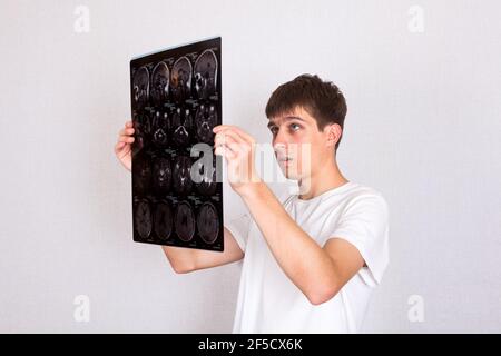 Un jeune homme inquiet tient le scanner à rayons X sur le mur blanc Arrière-plan Banque D'Images