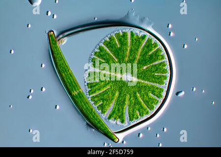 Algue verte (Micrasterias rotata), avec Clostridium dans une bulle d'eau, image microscopique de champ sombre, grossissement x100 par rapport à 35 mm, Allemagne Banque D'Images