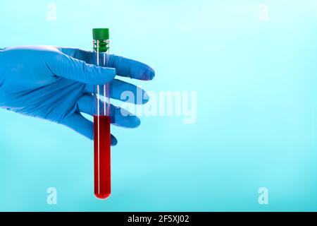 Main d'un médecin tenant une bouteille d'échantillon de sang. Banque D'Images