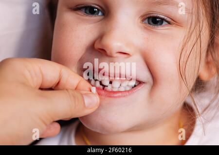 gros plan sur le visage d'une fille souriante et heureuse, avec sa première dent de bébé tombée dans la main de sa mère Banque D'Images