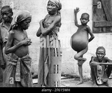 Biafra 1968-12-25 la guerre civile nigériane (également connue sous le nom de guerre du Biafran et guerre du Nigeria-Biafran). Famine dans la région de Biafra pendant la guerre. Photo: Sven-Erik Sjoberg / DN / TT / code 53 Banque D'Images