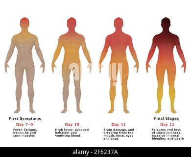 Progression d'Ebola, Illustration Banque D'Images