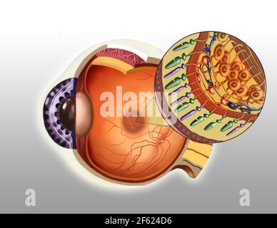 Dégénérescence maculaire, illustration Banque D'Images