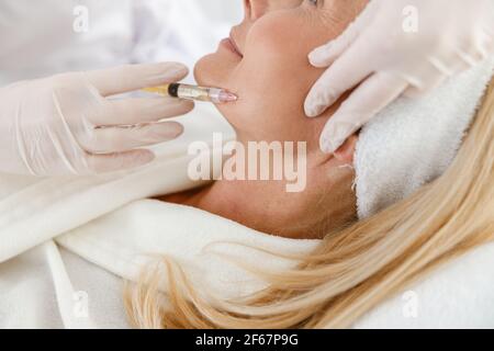 Gros plan concept de traitement photo d'une femme senior par une esthéticienne pour serrer et lisser les rides sur le visage peau Banque D'Images