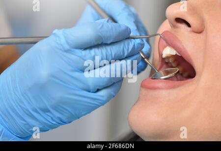 Le dentiste vérifie les dents des femmes à l'aide d'outils dentaires, en gros plan Banque D'Images