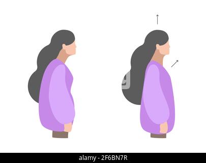 Illustration colorée isolée vectorielle. Exercices de cou par fille pour se détendre. Travailler avec le dos. Posture droite incorrecte et correcte. Concept créatif. Illustration de Vecteur