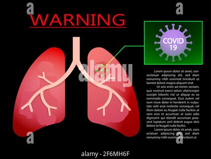 Infection pulmonaire par le virus Covid-19, infographie sur l'art vectoriel Illustration de Vecteur