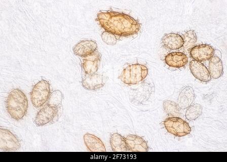 Truffe de Bourgogne (Tuber uncinatum), spores de truffe d'automne Banque D'Images