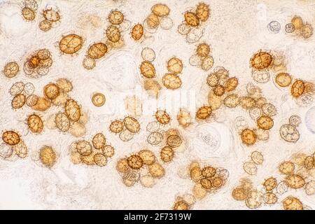 Truffe de Bourgogne (Tuber uncinatum), spores de truffe d'automne Banque D'Images