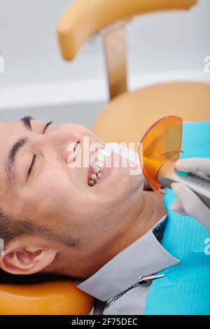 Dentiste utilisant la lumière de durcissement dentaire pour la polymérisation du composite dentaire Résine dans les dents du jeune homme asiatique Banque D'Images