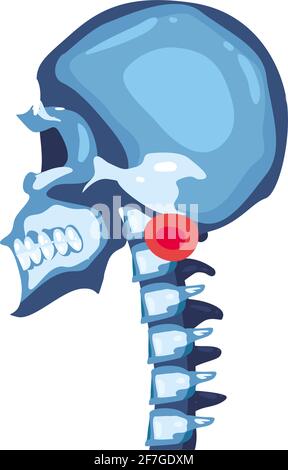 Crâne bleu de rhumatologie isolé Illustration de Vecteur