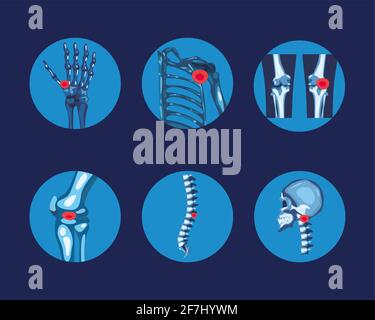 Groupe d'icônes d'os bleus de rhumatologie Illustration de Vecteur