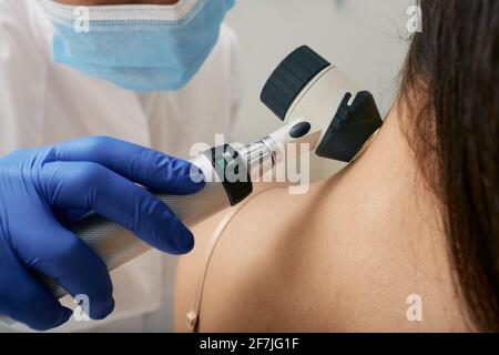 Dermatoscopie molaire. le médecin examine la taupe du patient avec un dermatoscope pour la prévention du mélanome, en gros plan. Banque D'Images