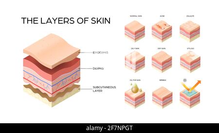 définir différents types de couches de peau coupe transversale de la structure de la peau humaine soins de la peau concept médical plat horizontal Illustration de Vecteur