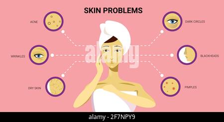 boutons de peau faciale acné différents types sur le visage de la femme pore comedones cosmétologie problèmes de soin de la peau concept plat portrait horizontal Illustration de Vecteur