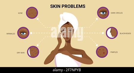 boutons de peau de visage acné différents types sur la femme américaine africaine visage pore comedones cosmétologie problèmes de soin de la peau concept plat portrait horizontal Illustration de Vecteur