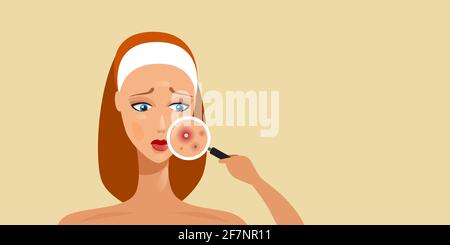 femme ayant des problèmes de peau faciale fille utilisant la loupe pour trouver acné sur la zone du visage portrait horizontal Illustration de Vecteur