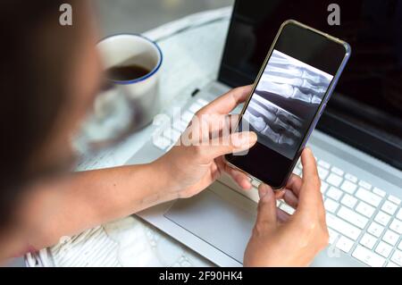 Femme regardant ses rayons X sur téléphone mobile à la maison, concept de médecin virtuel. Banque D'Images