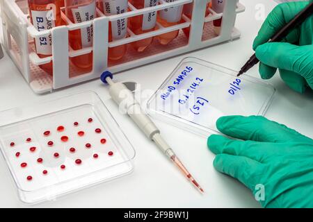 Analyse en laboratoire d'une nouvelle mutation SARS-COV-2 en Belgique à partir du Congo, connue sous le nom de Spike Insertion (si), dont le nom scientifique est B.1.214, ima conceptuel Banque D'Images