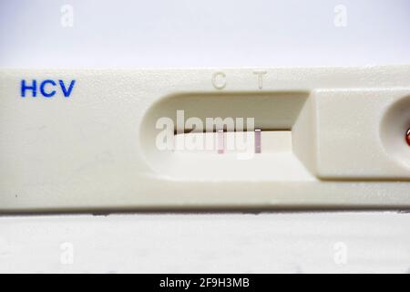 Un résultat positif pour la cassette du kit de test rapide de l'hépatite C qui vérifie les anticorps du virus de l'hépatite c détenus par une main du personnel médical Banque D'Images