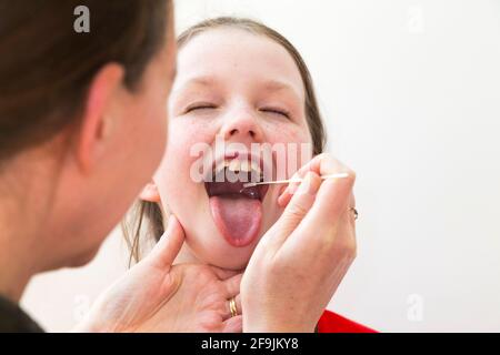 Âge scolaire enfant école primaire fille de neuf ans / 9 ans ayant des échantillons prélevés de sa gorge pour une utilisation dans un test de flux latéral LFT de la société chinoise Innova. Angleterre Royaume-Uni. (123) Banque D'Images